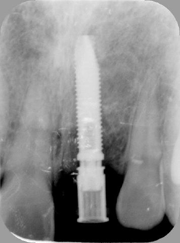 200904242209347581_2.jpg